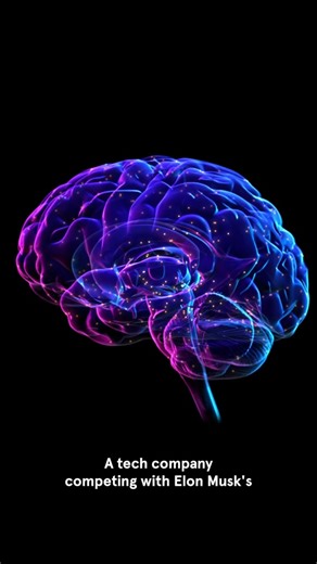 #Neuralink rival Synchron is connecting its brain–computer interface with consumer technologies to allow people with paralysis more functionality. #brain #amazon #alexa 📹 editor: @alanawhyy