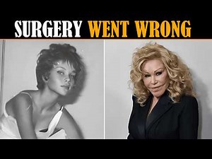 15 Celebrities Left Unrecognizable After Plastic Surgery Gone Wrong