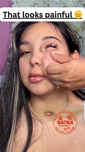 57K views · 50 reactions |  It looked small, but wait till you see the ending! #drpimplepopper #grossaddiction | Dr. TOM animal Care | Facebook