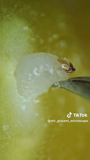 МИР ГЛАЗАМИ МИКРОСКОПА (@mir_glazami_microscopa)’s video of Microscope