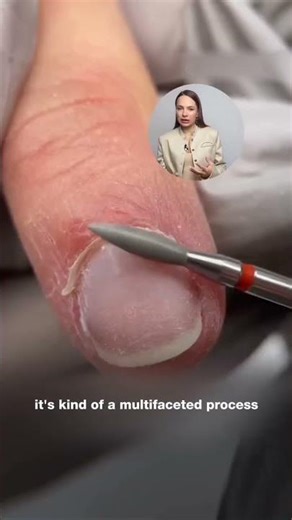 Remove problematic cuticles 😱💅🏻#shorts