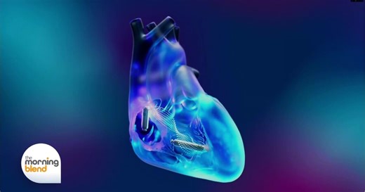 The World’s First Dual Chamber Leadless Pacemaker