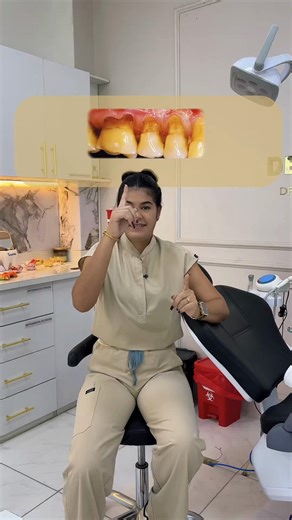 ¿Sabías que cepillarte mal los dientes puede causar desgaste dental? 🦷 No olvides visitar a tu odontóloga favorita 🤝 #odontologia #desgastedental #quevedeñadeverdad #quevedo