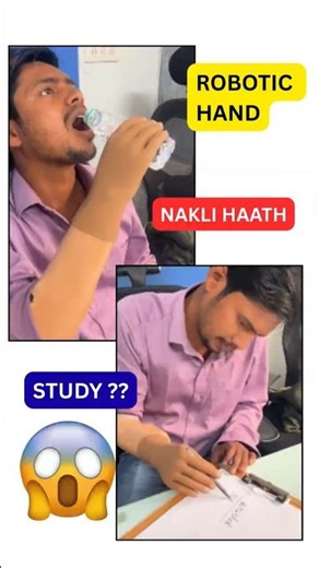 Robotic Hand Price | Below Elbow Artificial Hand | Myoelectrical Hand #bionichand #artificialhand