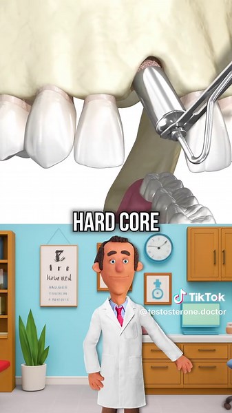 What Happens When You Lose an Adult Tooth and Get a Dental Implant? #healthy #implant #tooth #dentist