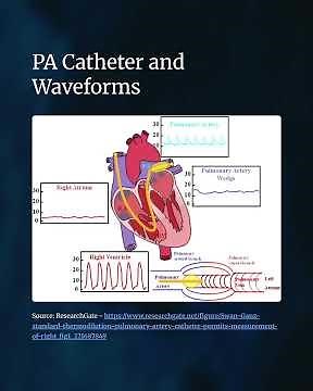 PA Catheters: Waveforms, where it sits, and thermodilution.