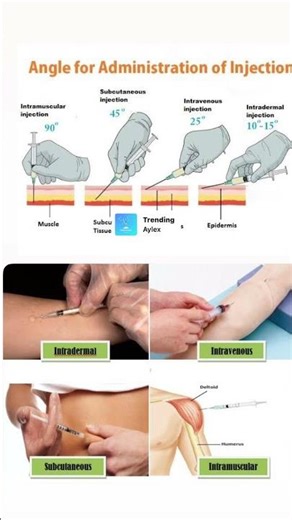 Angles for administration of injection
