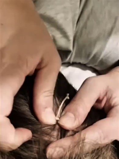 #removeblackheads #satisfying #relax #varied #coper_71