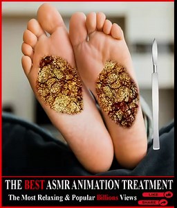 Get rid of Black Seed & Parasite Worm infection foot | Lline Theodora