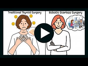 Robotic Thyroid Surgery: No Neck Scar, Faster Recovery!