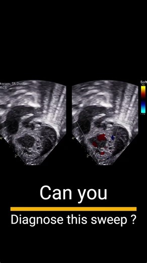 Online Pediatric Echocardiography Course