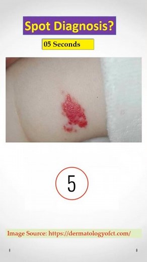 Dermatology Spot Diagnosis Quiz #43. Doctors, check your Clinical Skill