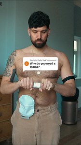 Three different types of stoma.. | Mr Colitis Crohns