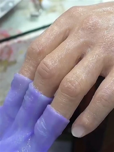 Left-Arm Prosthesis: 3D Scanning to Lifelike Silicone Skin