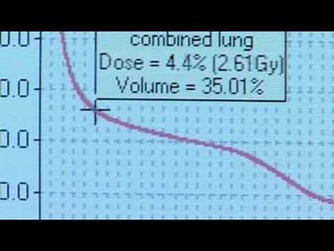 Radiation: dose volume histogram (5/5)
