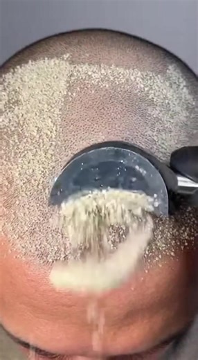 Exploring Oddly Satisfying Visuals and Trypophobia