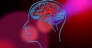 Telestroke Services at Spectrum Health