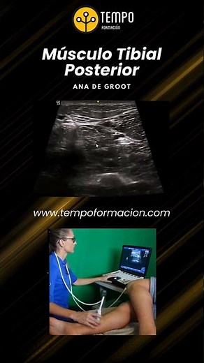 Musculo tibial posterior y ecografía con Ana de Groot