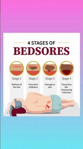 four stages of bedsore /decubitus ulcer/pressure sore/fundamental of Nursing 📌📌📌