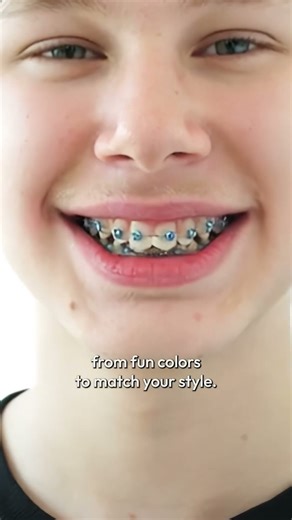 What Do Power Chains on Braces Do? 🤔 | How They Close Gaps & Speed Up Treatment