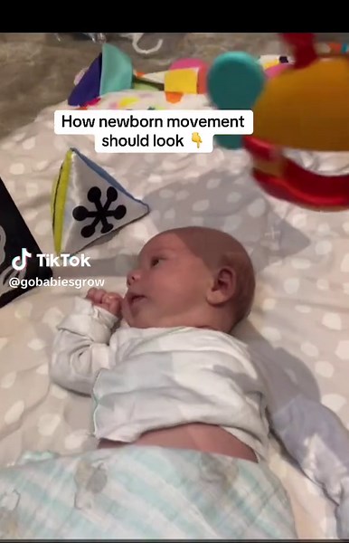 🫶🏻When your baby is lying on their back, one of the most important skills you can look for is turning their head fully to both sides. 🫶🏻We’re looking for full range — cheek to cheek. Their head should move comfortably right and left without hesitation or fussing. 🫶🏻(this little one is wearing an EarWell to gently correct an ear that was folded from womb compression) It seems so simple — but it’s actually a foundational motor pattern that shapes everything that comes next: feeding, rolling,