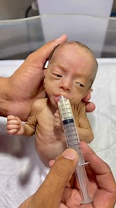 Baby naveed now day 5 feeling very well #nicubaby #neonatologist #newbornbaby #cutebaby #babygirl #baby | Gautam Ashish