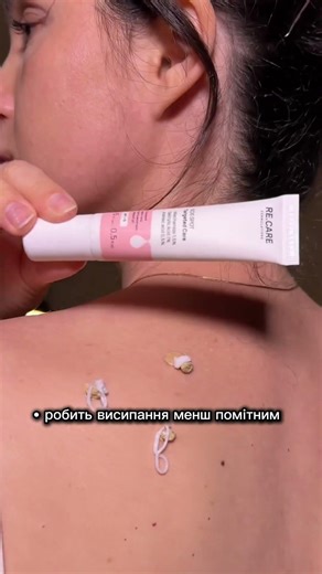 Як позбавляєтесь поодиноких прищів? За пром0 liza 10% на ‪@recare.formulations‬ #висипи #прищі