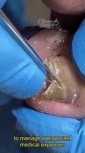 616K views · 2.1K reactions | The Benefits of Foot Massage Rollers #MassageRollers #FootRelief | Chesapeake Beautiful | Facebook