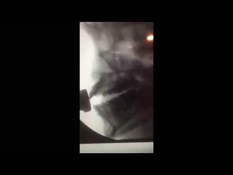 Bach Artist: Peter Bond X-Ray Trumpeting!