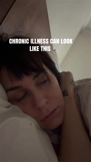 just a reminder, we’re not doing better. we’re faking “normal” harder. #chronicillness #chronicpain #chronicillnessawareness #ehlersdanlossyndrome #cirrhosis