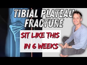 Tibial Plateau Fracture: Two Essential Stretches You Must Start Immediately