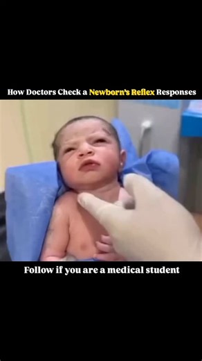 @medicalstudent.io on Instagram: "Doctors gently observe a newborn’s natural reflexes to make sure the baby’s nervous system is developing well, watching how they react to simple movements and touches such as gripping a finger, turning their head when a cheek is stroked, startling at sudden sounds, or stepping when their feet touch a surface, and each tiny response helps show that the brain and nerves are communicating properly while giving parents reassuring signs of healthy growth and coordina
