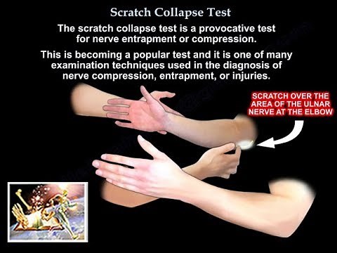 Scratch Collapse Test for testing nerve injury - Everything You Need To Know - Dr. Nabil Ebraheim