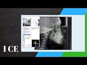 Orthodontic Ceph tracing with the Dolphin Software | Orthodontic Matters 26