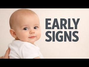 Early Signs of Flat Head Syndrome (Most Parents Miss This)