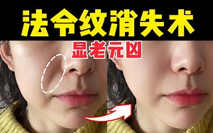 0成本淡化法令纹，纹路产生原理 淡纹手法
