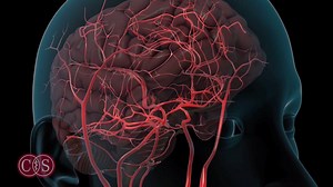 20K views · 154 reactions | Do you know how to spot the signs of a stroke? Watch Dr. Patrick Lyden, director of the Cedars-Sinai Stroke Center, share the subtle symptoms you might not know about. | Cedars-Sinai | Facebook