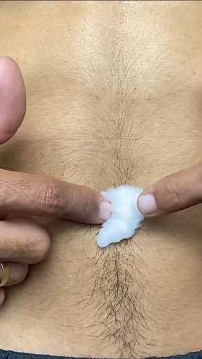 144K views · 1.5K reactions | A cotton ball in your belly button will change your life  | Top Tips | Facebook