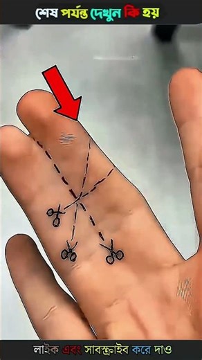 How do you fix your fingers 🫵 when they are all stuck together 🤔?😱