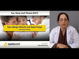 Non-Allergic Rhinitis and Nasal Polypi | Antrochoanal Polyp