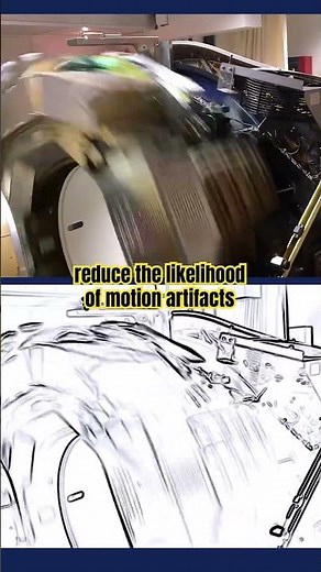CT Scan Gantry Rotation Speeds Matter. See Why! #physics #science #radiology #medicalimaging