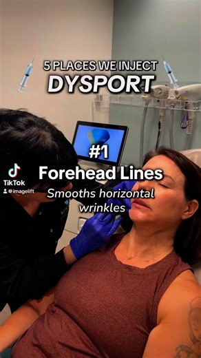 ✨ 𝟓 𝐊𝐞𝐲 𝐏𝐥𝐚𝐜𝐞𝐬 𝐖𝐞 𝐋𝐨𝐯𝐞 𝐟𝐨𝐫 𝐃𝐲𝐬𝐩𝐨𝐫𝐭 ✨ Smooth, sculpt, and refresh in minutes: 1️⃣ 𝙁𝙤𝙧𝙚𝙝𝙚𝙖𝙙 – Bye-bye worry lines 2️⃣ 𝙂𝙡𝙖𝙗𝙚𝙡𝙡𝙖𝙧 “11𝙨” – No more frown lines 3️⃣ 𝘾𝙧𝙤𝙬’𝙨 𝙁𝙚𝙚𝙩 – Softer eye corners 4️⃣ 𝙈𝙖𝙨𝙨𝙚𝙩𝙚𝙧 – Sleeker, slimmer jawline 5️⃣ 𝙉𝙚𝙘𝙠 𝘽𝙖𝙣𝙙𝙨 – Smooth, youthful neck 💉 𝐐𝐮𝐢𝐜𝐤 𝐭𝐫𝐞𝐚𝐭𝐦𝐞𝐧𝐭, 𝐧𝐚𝐭𝐮𝐫𝐚𝐥 𝐫𝐞𝐬𝐮𝐥𝐭𝐬, 𝐭𝐚𝐢𝐥𝐨𝐫𝐞𝐝 𝐣𝐮𝐬𝐭 𝐟𝐨𝐫 𝐲𝐨𝐮! 🍂𝘿𝙤𝙣’𝙩 𝙢𝙞𝙨𝙨 𝙤𝙪𝙧 𝙎𝙚𝙥𝙩𝙚𝙢𝙗𝙚𝙧 𝙨𝙥𝙚�