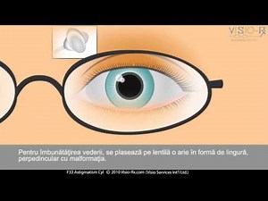 Ochelari de vedere cu cilindru. Corectarea astigmatismului.