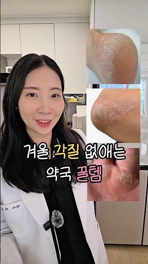 겨울 온몸 각질 제거 꿀템｜우레아 크림 이렇게 쓰세요 (약국템)