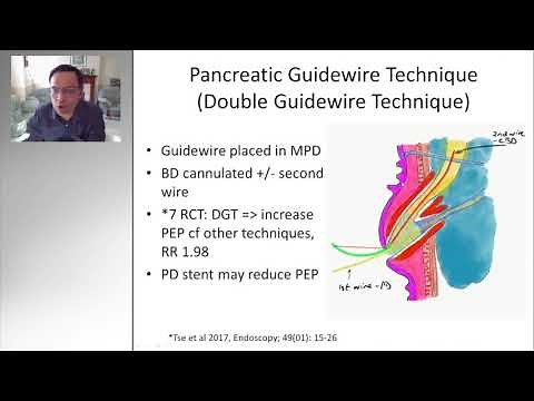 ERCP TIPS AND TRICKS: DIFFICULT BILIARY CANNULATION