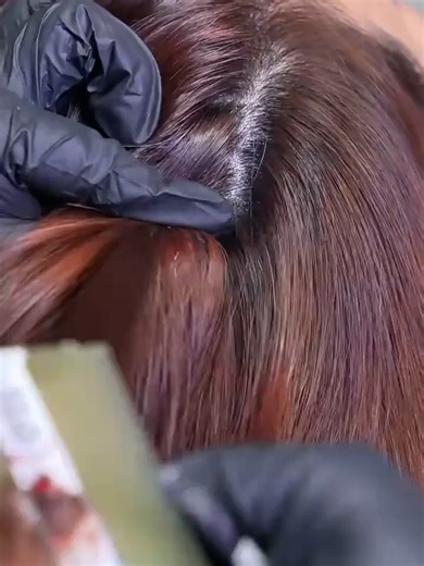 Effective Dandruff Removal and Scalp Care Techniques