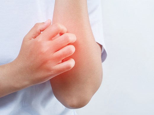 Researchers identify what’s behind that urge to scratch — Harvard Gazette