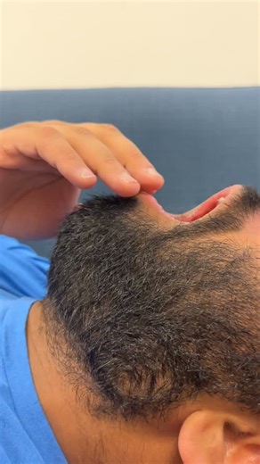 Ever feel a muscle twitch when you’re working out hard? 🏋️‍♂️ That’s your nerves and muscles having a little “miscommunication”! When a muscle gets super tired, the tiny wires (nerves) that tell it what to do can get a little scrambled, causing a twitch. It’s like your muscles are saying, “We’re confused!” 😵‍💫😵‍💫 Now, imagine retraining a muscle that’s been injured or isn’t working right. That’s #neuromuscularReeducation! In this video, our patient is working hard to reteach his tongue how 