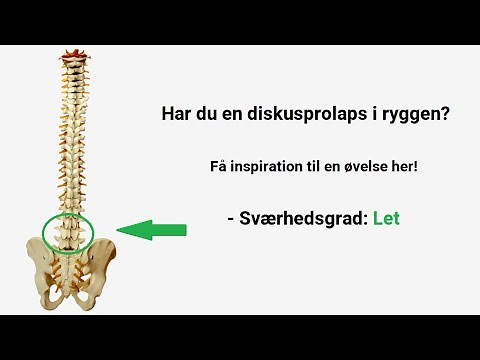 Diskusprolaps øvelser: Den her skal du prøve! Sværhedsgrad: Let (1/3)