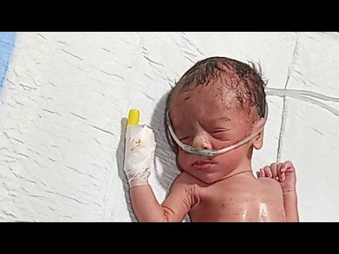 Everything About NICU Care: Health, Treatment & Daily Life”